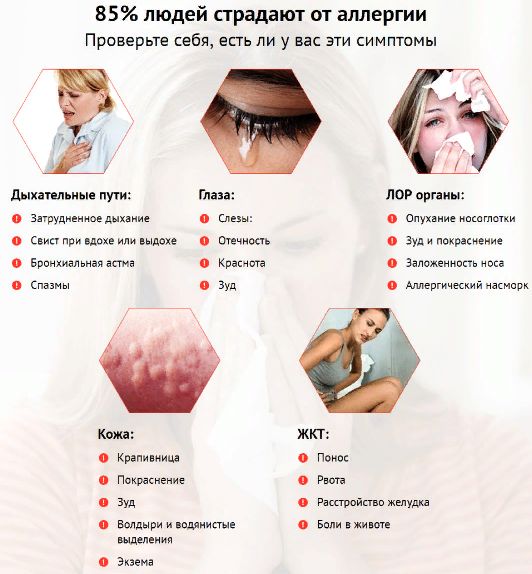 симптомы и признаки аллергии