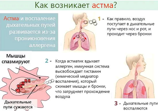 механизм возникновения астмы