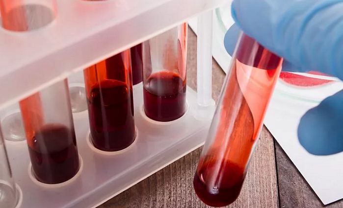 анализ крови на гликированный гемоглобин