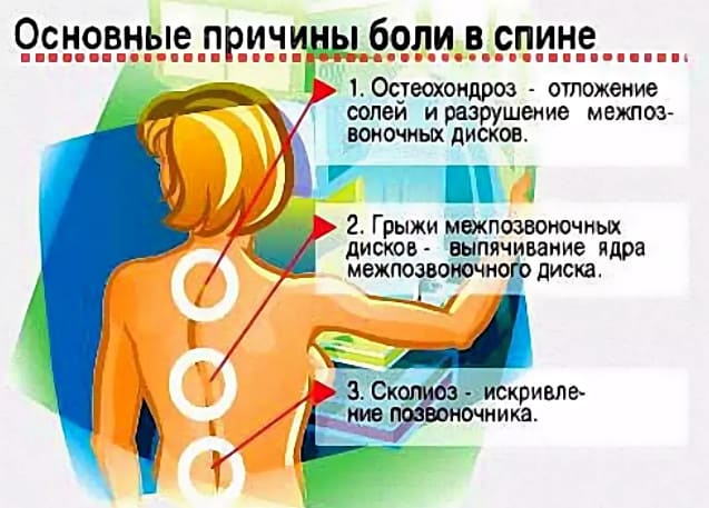 причины болей в спине у женщин